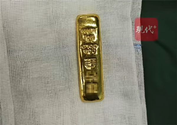 吞金自杀是真的吗？11岁男孩误吞100克金条手术取出 