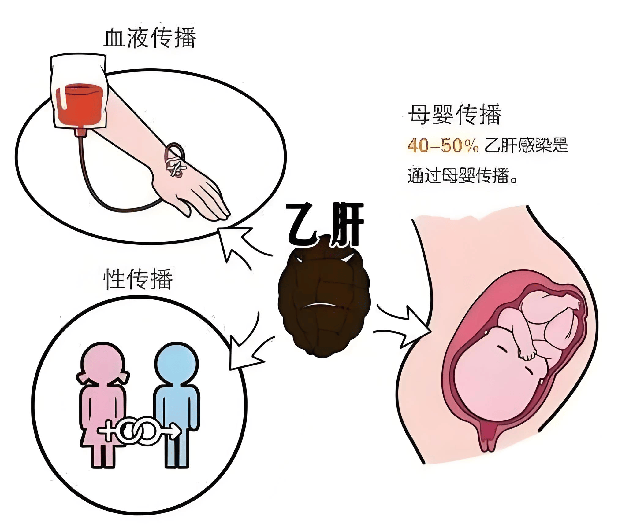 夫妻之间，传染乙肝的几率大吗? 