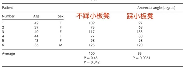 上厕所 坐着好还是蹲着好？最佳姿势竟然是……