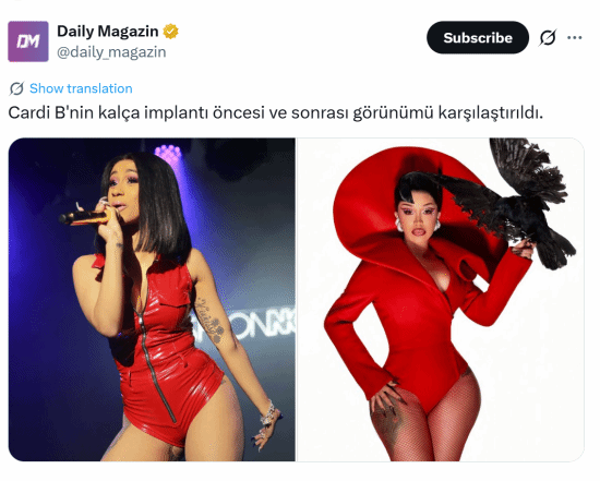 Cardi B整形前后对比曝光 曾花800美元黑市注射