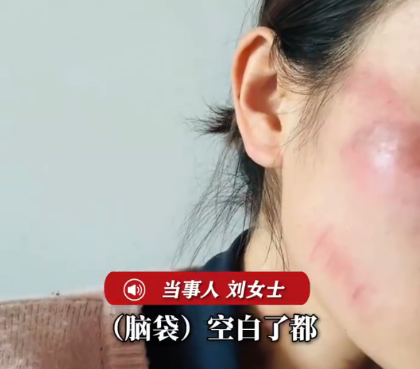 操作太危险！女子推液压千斤顶摔倒致脸部擦伤